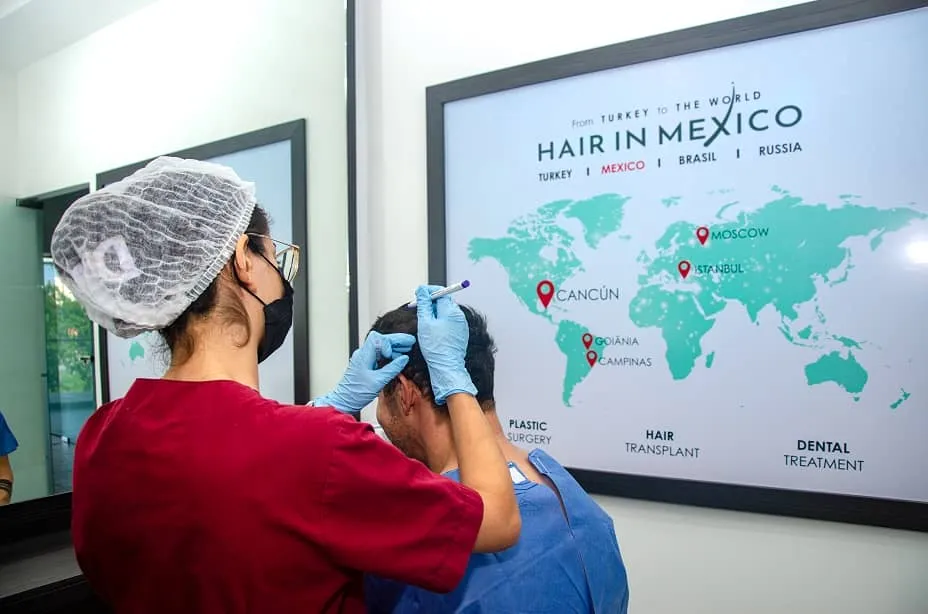 Especialista de Hair in Mexico dibujando la nueva línea frontal de un paciente